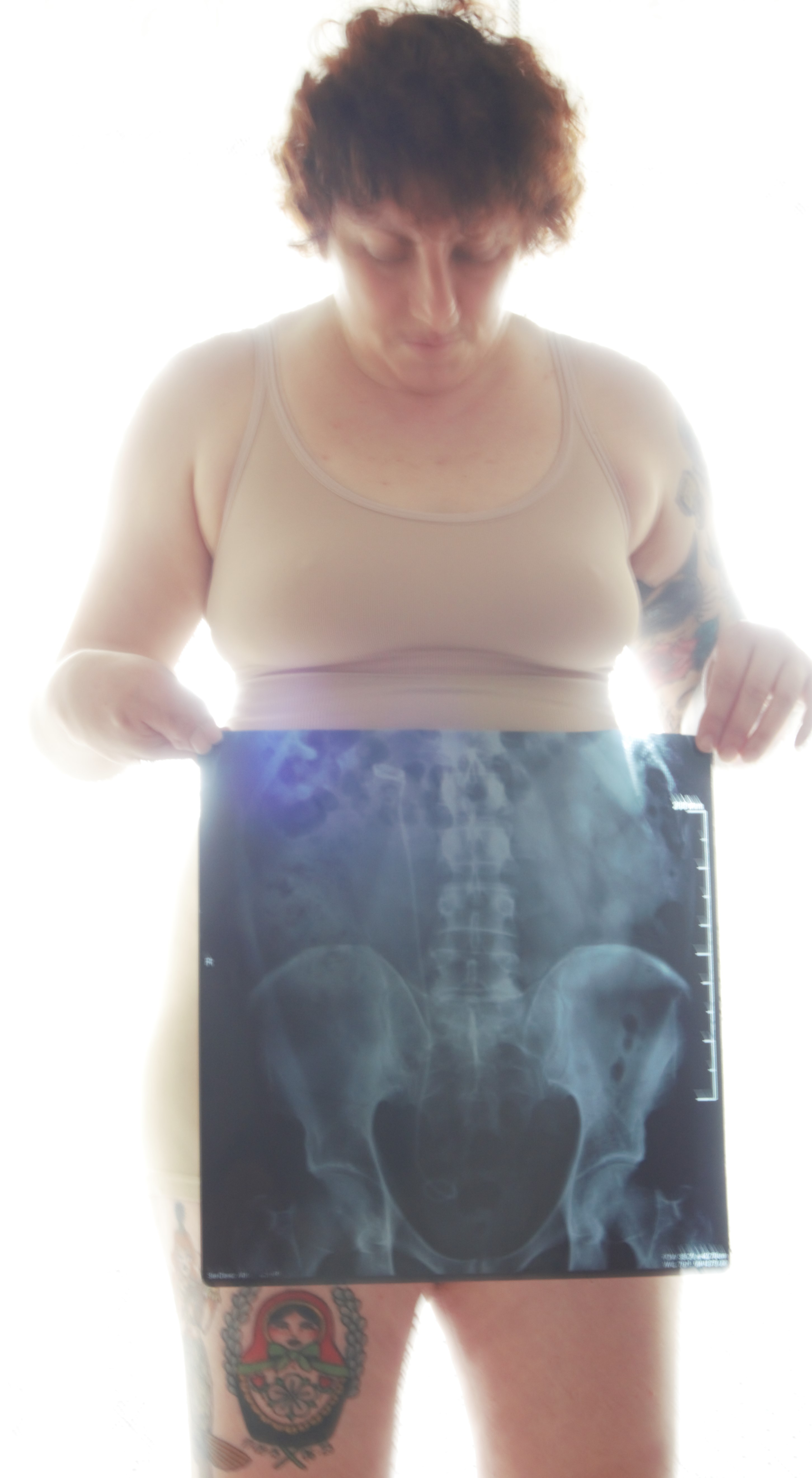 Um Raio X dos ossos da bacia é colocado em frente aos quadris