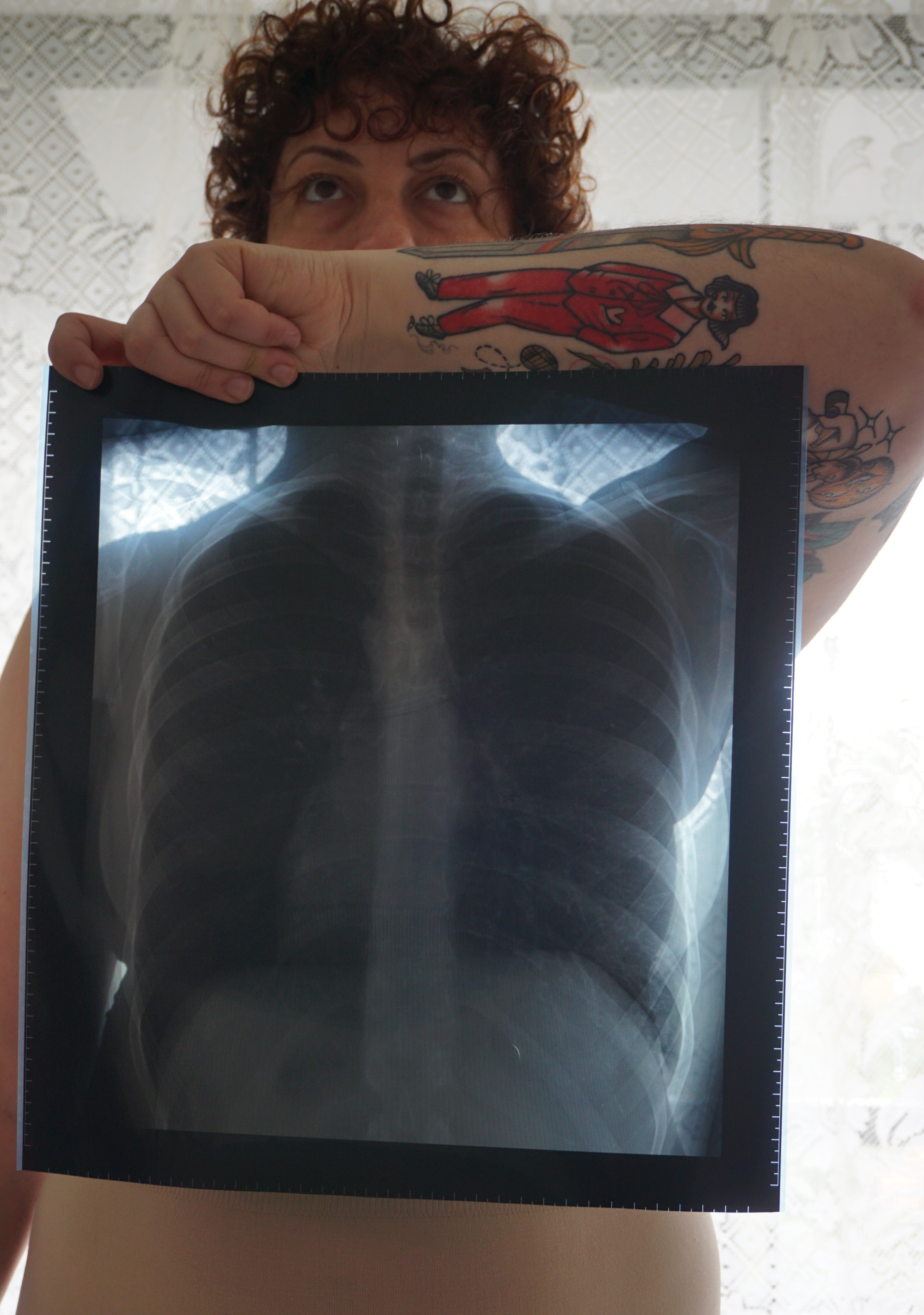 Um Raio X de pulmão é colocado em frente ao peito, segurado pelo braço esquerdo.