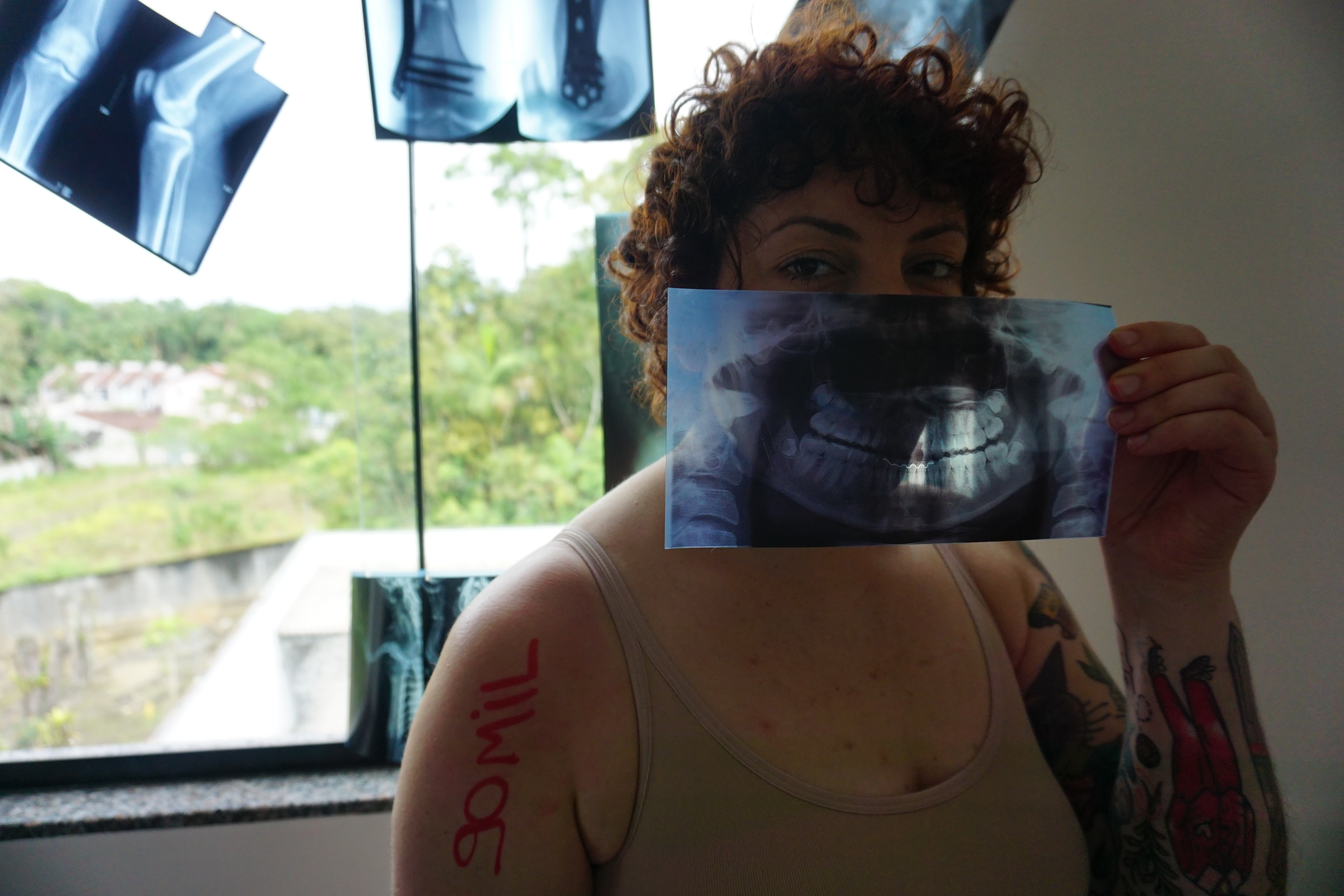 Nathi olha para a câmera de lado, em frente ao seu rosto, um raio X de dentes e boca, atrás uma janela com várias folhas de raio x penduradas, em seu ombro direito está escrito em vermelho 90 mil.