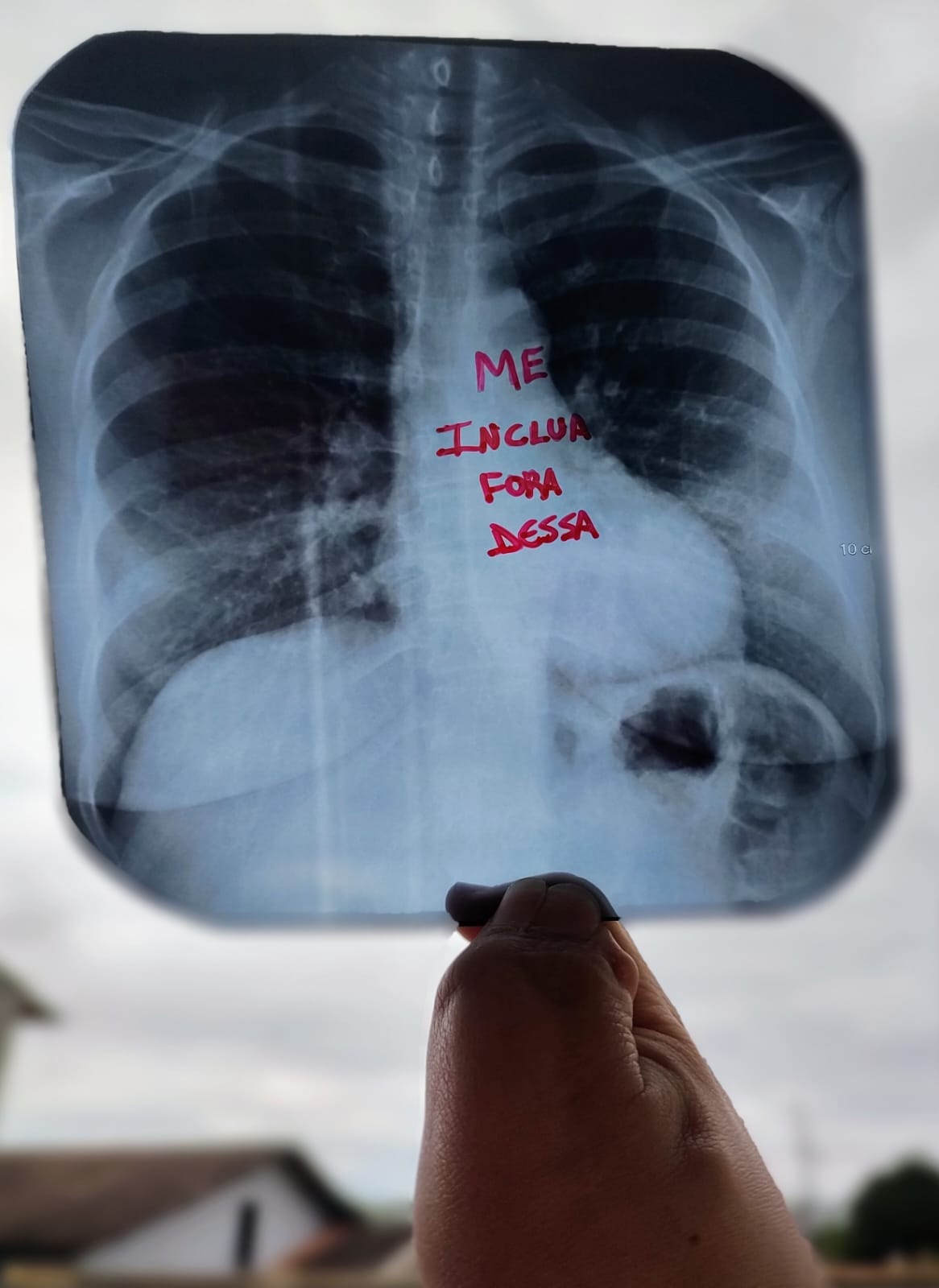 Raio X de um pulmão, perto do coração a frase escrita em vermelho: Me inclua fora dessa.