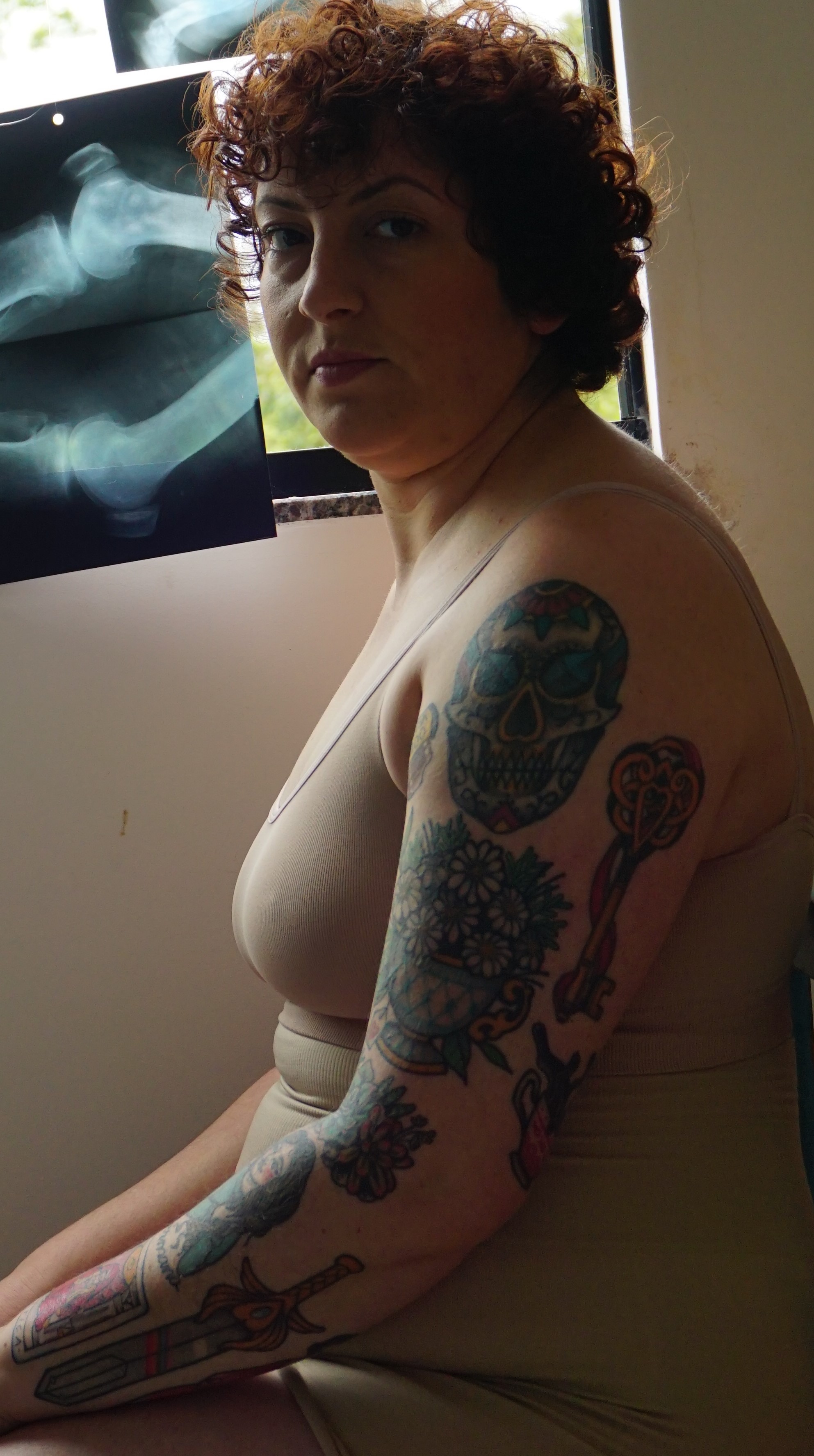 Nathi olha para a câmera de perfil, atrás vários raio X pendurados.